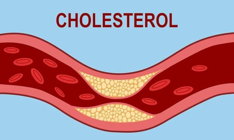 Χοληστερίνη: Οι φυσιολογικές τιμές – Ποιοι πρέπει να την ελέγχουν τακτικά