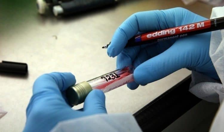 Πώς σχετίζεται ο κορωνοϊός με την ομάδα αίματος- Μειωμένος κίνδυνος για όσους έχουν ομάδα αίματος 0