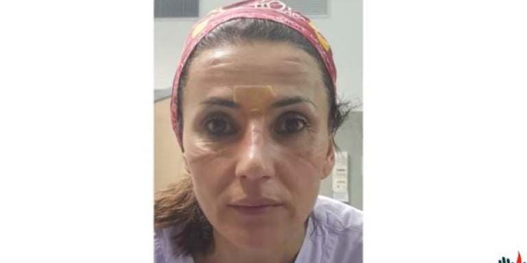 Κορωνοϊός: Συνταρακτικό βίντεο των Ιταλών γιατρών και νοσηλευτών -Με πρόσωπα χαρακωμένα από τις μάσκες
