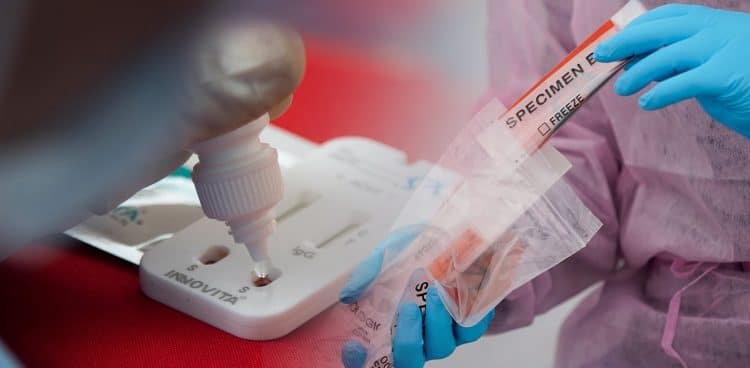Κορονοϊός: Ποιοι μπορούν να κάνουν δωρεάν rapid test και μοριακό έλεγχο – Τα κριτήρια