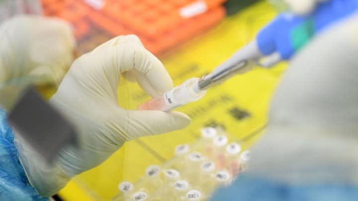 Η FDA ενέκρινε το πρώτο διαγνωστικό τεστ αυτο-ελέγχου για Covid-19. Aποτελέσματα σε 30 λεπτά