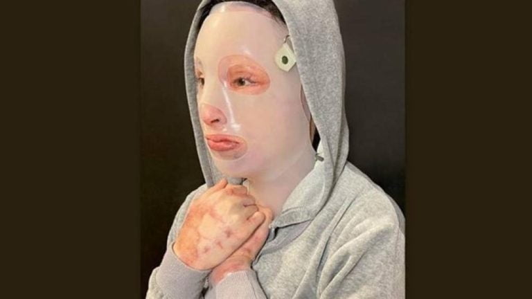 Iωάννα Παλιοσπύρου: Οι σοκαριστικές φωτογραφίες που ανέβασε στο Instagram  από το πρώτο χειρουργείο