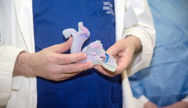 Νοσοκομείο Παπαγεωργίου: Τεχνολογία 3D στις επεμβάσεις βαλβίδων καρδιάς