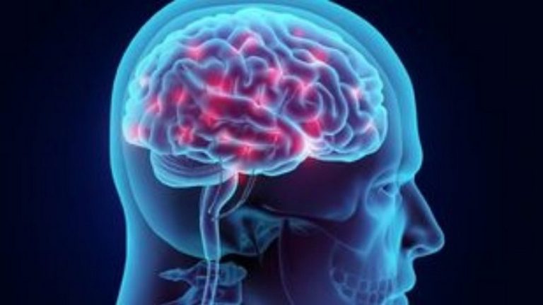 Έλληνας νευρολόγος στη Βρετανία φωτίζει το ξεκίνημα του Πάρκινσον στον εγκέφαλο