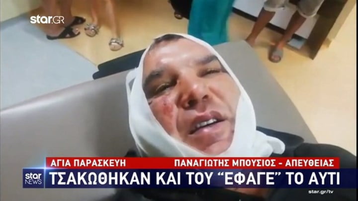 Άγριος καβγάς σε λαϊκή: Τον δάγκωσαν και του έκοψαν το αυτί – Τι λέει το θύμα της επίθεσης(βίντεο)