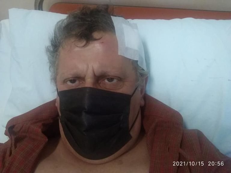 Σέρρες: Για τις ανάγκες του ρεπορτάζ …έσπασε το κεφάλι του -φωτο