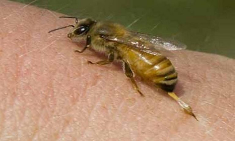 Τσίμπημα από μέλισσα: Δείτε τι πρέπει να κάνετε