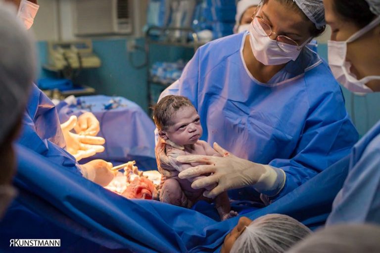 Viral φωτογραφία: Νεογέννητο κοιτά με νεύρα τον μαιευτήρα (φωτο)