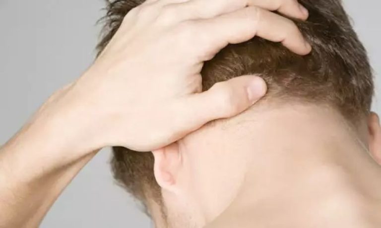 Πονοκέφαλος στο πίσω μέρος του κεφαλιού: Όλες οι πιθανές αιτίες – Τα συμπτώματα ότι πρέπει να σας δει γιατρός