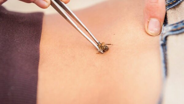 Νόσος Lyme- Μεταδίδεται από τσιμπούρια