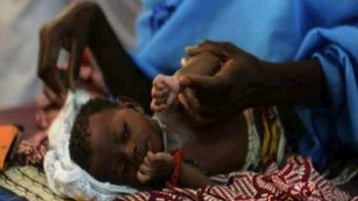 Υεμένη: Σε πρωτόγνωρα επίπεδα έχει φτάσει ο υποσιτισμός των παιδιών, προειδοποιεί ο ΟΗΕ