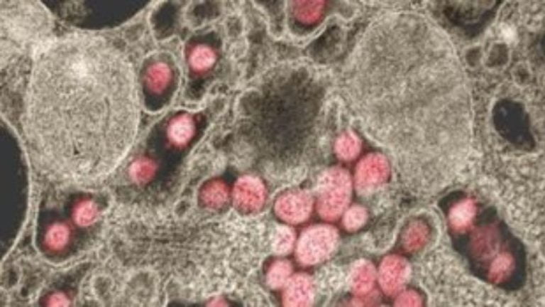 Βακτήρια της σπάνιας αλλά θανατηφόρας λοίμωξης Μελιοείδωση εντοπίστηκαν στον Μισισιπή