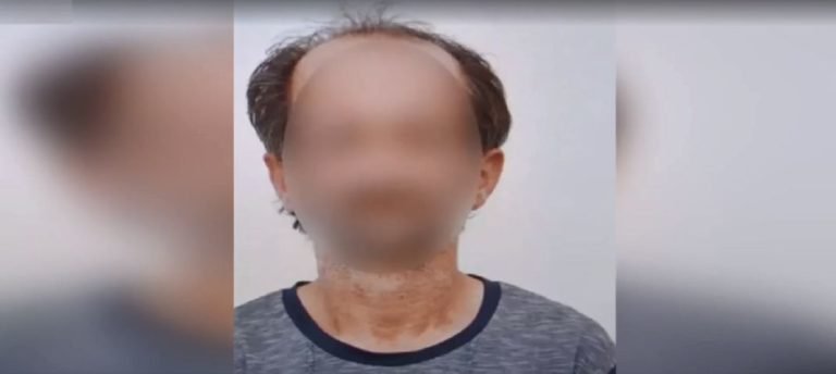 Ζάκυνθος: Προθεσμία για να απολογηθεί πήρε ο 49χρονος συζυγοκτόνος-  «Θολώνω με το τι έκανε» λέει ο γιος του 