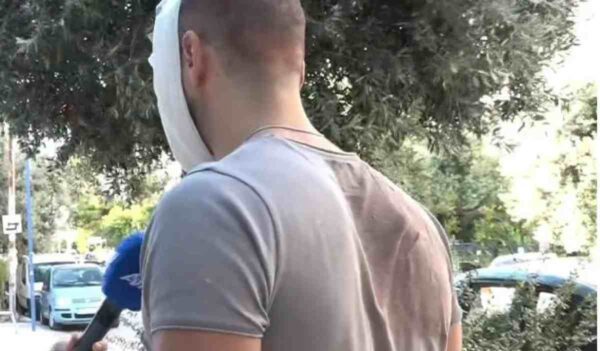 Ατύχημα στο Allou Fun Park