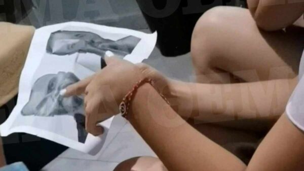 Βιασμός 12χρονης