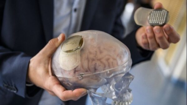 Έλον Μασκ: Η start-up Neuralink του μεγιστάνα θα δοκιμάσει εγκεφαλικά εμφυτεύματα σε ανθρώπους