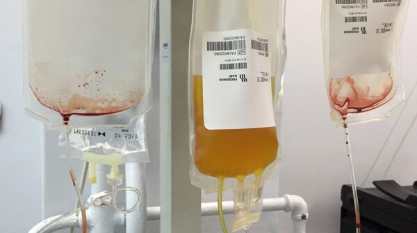 Δωρεά πλάσματος: Ζήτημα ζωής για χιλιάδες ασθενείς – Πώς η Ευρώπη θα αποκτήσει επάρκεια