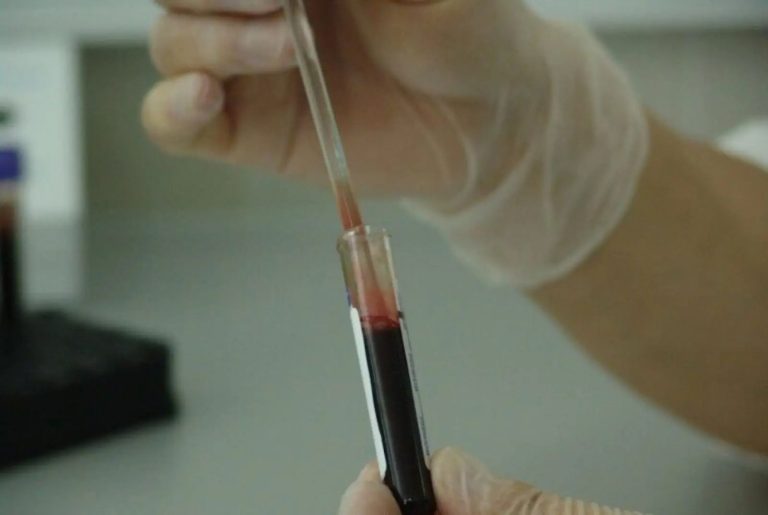 Καρκίνος του αίματος: Εντυπωσιακά αποτελέσματα από κλινικές δοκιμές με πειραματικά ανοσοθεραπευτικά φάρμακα