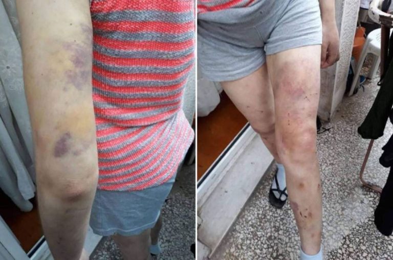 Φαίη Μπακογιώργου: Τη χτυπούσαν και την εξέδιδαν – Τα βασανιστήρια που υπέστη από τη μητέρα και την αδερφή της
