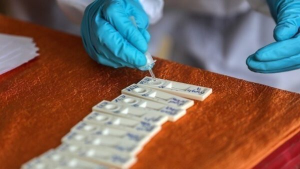 Η αύξηση των κρουσμάτων covid-19 και άλλων αναπνευστικών λοιμώξεων δοκιμάζει τις αντοχές του ΕΣΥ για 4η χρονιά