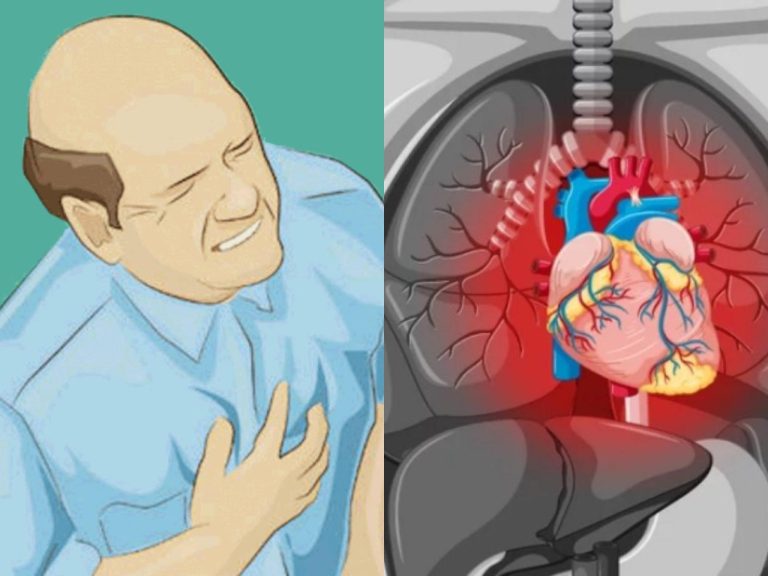 COVID-19: Αυξήθηκαν ή μειώθηκαν τα καρδιαγγειακά επεισόδια κατά την πανδημία;