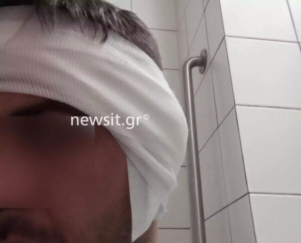 «Δάγκωσε το αυτί μου και έκοψε κομμάτι με τα δόντια του» – Τι περιγράφει ο διανομέας από την Πέλλα