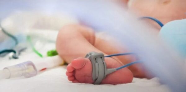 Συγκλονιστικό ΒΙΝΤΕΟ από τη στιγμή της αποσωλήνωσης του 35 ημερών βρέφους – Η καρδιά του χτυπά μόνη της ξανά