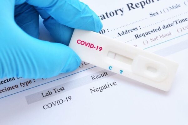 ΕΟΔΥ: Δωρεάν σημεία rapid test, σήμερα Τρίτη 19 Μαρτίου