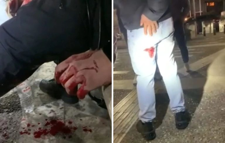 Βίντεο από την άγρια επίθεση σε δύο αδέρφια στη Νέα Φιλαδέλφεια με σιδερένια ράβδο και μαχαίρι