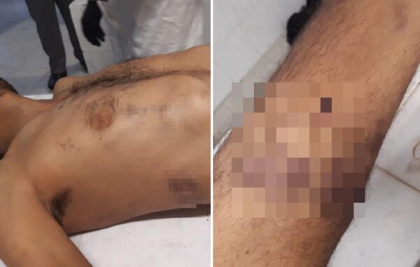 Καταγγελία για βασανισμό μέχρι θανάτου μετανάστη στο Αστυνομικό Τμήμα Αγίου Παντελεήμονα – Σκληρές εικόνες