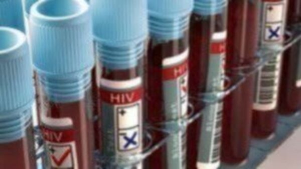ΕΟΔΥ: 550 νέα περιστατικά HIV λοίμωξης- Αυξημένο το ποσοστό με ακαθόριστο τρόπο μόλυνσης