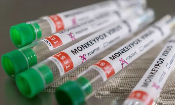 Ιός Mpox: Συναγερμός στον ΕΟΔΥ: Καταγράφηκαν 18 επιβεβαιωμένα κρούσματα