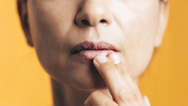 Έρπης στα χείλη: Ο αρχαιότερος ιός ίσως φτάνει στο τέλος του