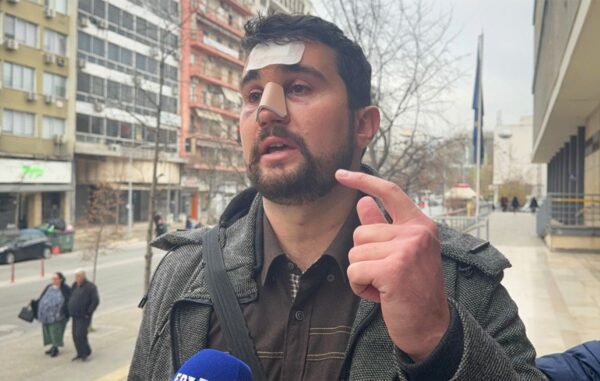 “Του είπα “περάστε κύριε” και με άρχισε στα μπουνίδια” – Καταδικάστηκε οδηγός ΙΧ που ξυλοκόπησε ταξιτζή στη Θεσσαλονίκη