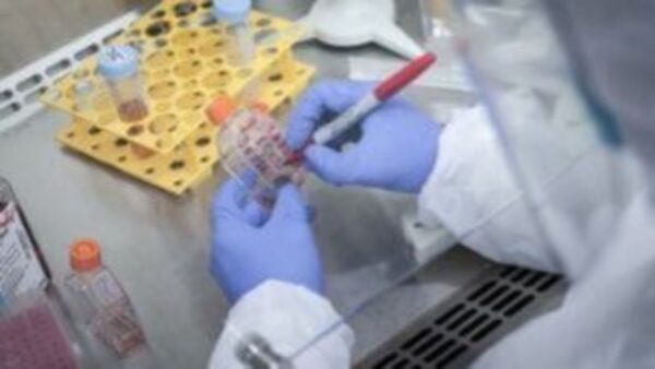 Παγκόσμια Ημέρα Φυματίωσης: Η φυματίωση δεν ανήκει στο παρελθόν, παραμένει παγκόσμια πρόκληση
