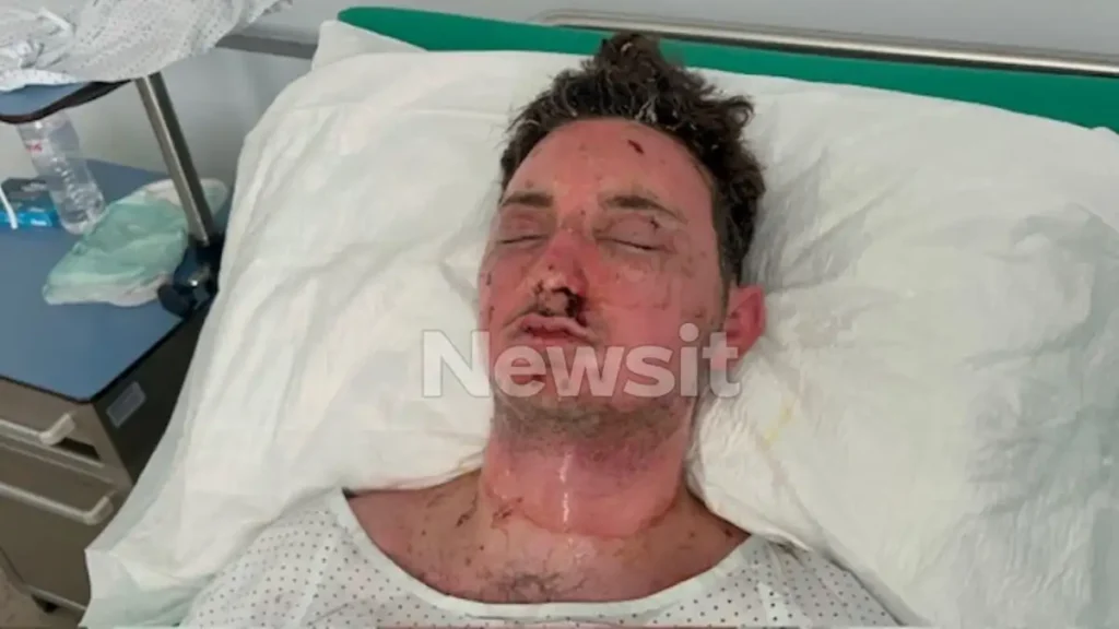 Σέρρες: “Έτρεχε αίμα από το μάτι μου, τυφλώθηκα”, λέει ο 19χρονος ψυκτικός που τραυματίστηκε από την έκρηξη στο νοσοκομείο