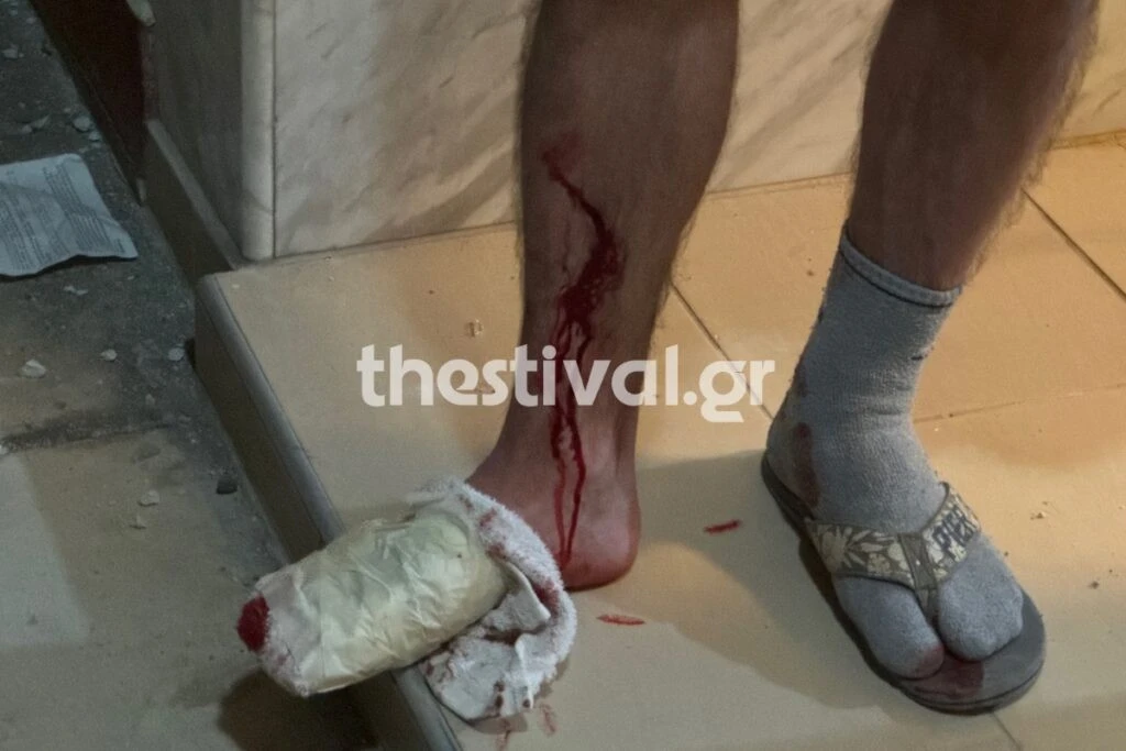 Θεσσαλονίκη: Ισχυρή έκρηξη σε είσοδο πολυκατοικίας στις Συκιές