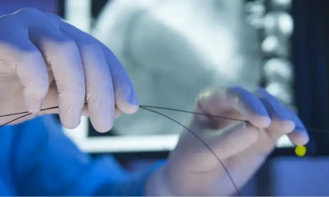 Πότε μπορεί να χρειαστεί κανείς στεντ (stent) και πότε δεν συνιστάται η τοποθέτησή του