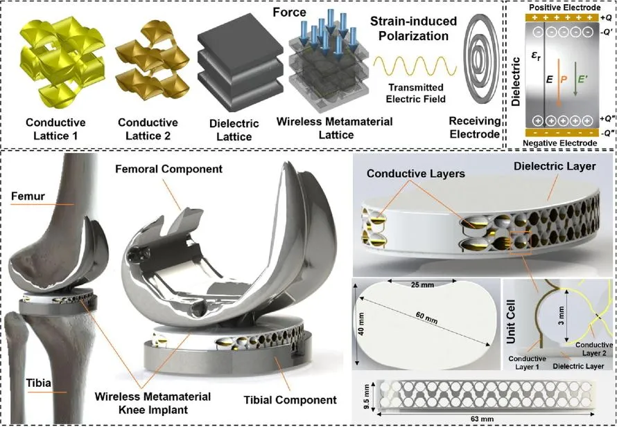 Εμφύτευμα σπονδυλικής στήλης παρακολουθεί την επούλωση από το εσωτερικό του σώματος