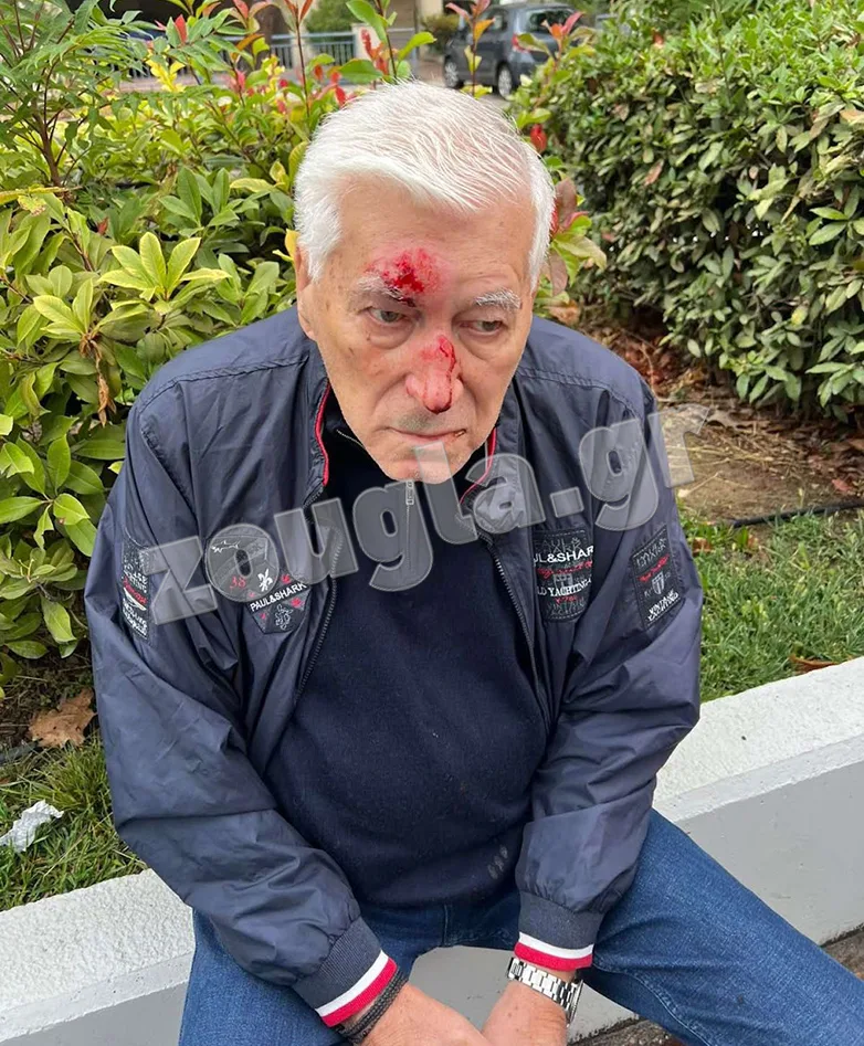 Καταγγελία: Γνωστός γιατρός της Θεσσαλονίκης ξυλοκόπησε ηλικιωμένο έπειτα από τροχαίο