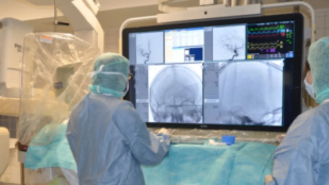 Το πρώτο Hellenic Stroke School στην Αθήνα - Σωτήρια η θεραπεία της θρομβεκτομής - Σχεδόν 35.000 εγκεφαλικά επεισόδια ετησίως στην Ελλάδα