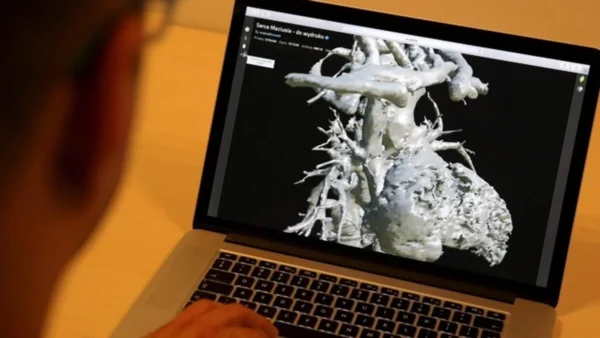 Καρδιακή Ανεπάρκεια: Η εξάπλωσή της έχει πάρει μορφή πανδημίας