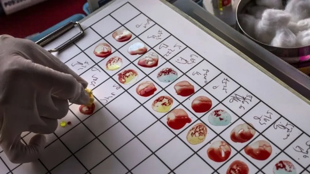 Υψηλότερα επίπεδα βιταμίνης D στο αίμα μπορεί να συνδέονται με χαμηλότερο κίνδυνο Αλτσχάιμερ